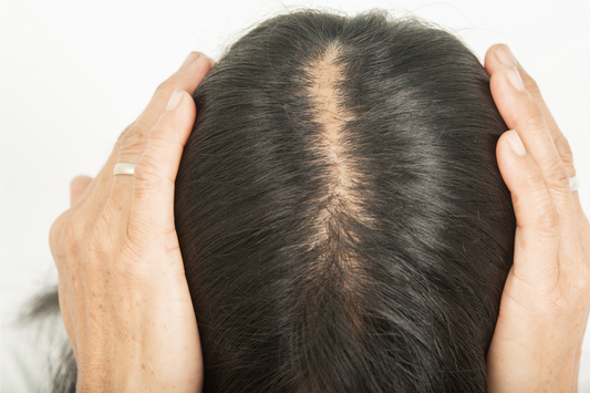woman with thinning hair