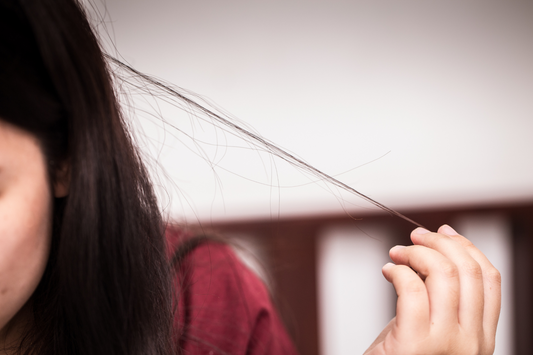 Trichotillomania: Celebrities Pull Their Hair Out Too