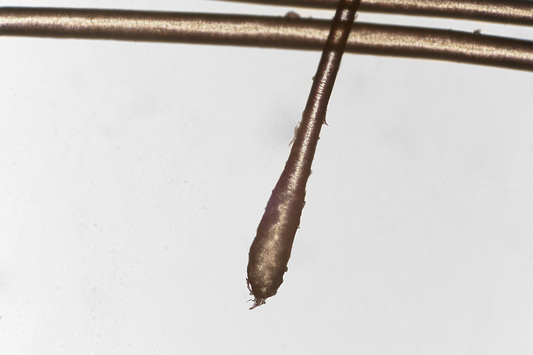 Can Hair Follicle Stimulation Lead to Hair Growth?