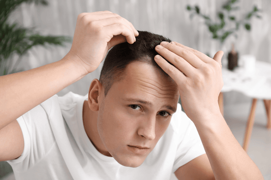 maturing hairline vs balding