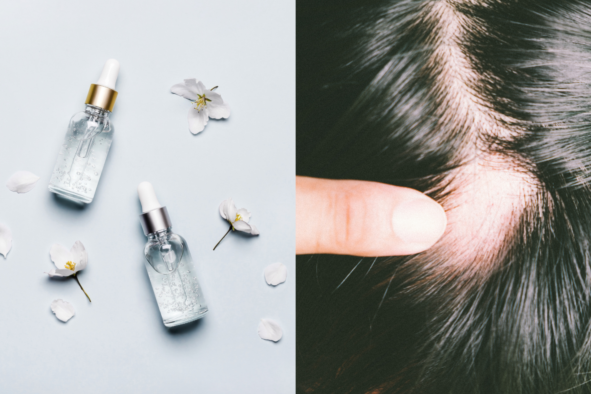 Eksisterer ~ side Pelagic Can Retinol Cause Hair Loss? – Revela