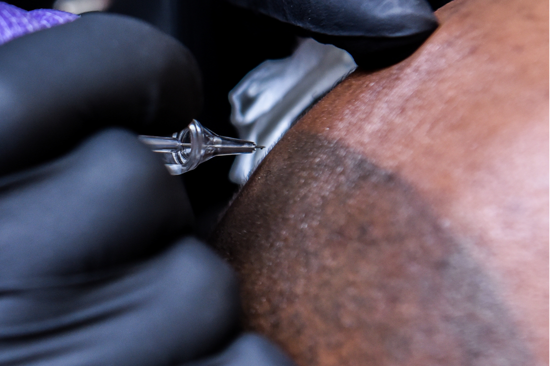 scalp micropigmentation fair hair