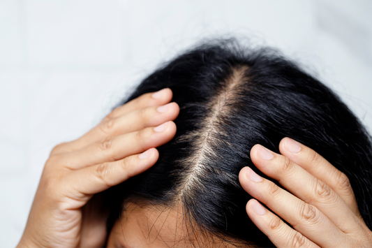 Hair Shedding vs. Hair Loss: Understanding the Difference