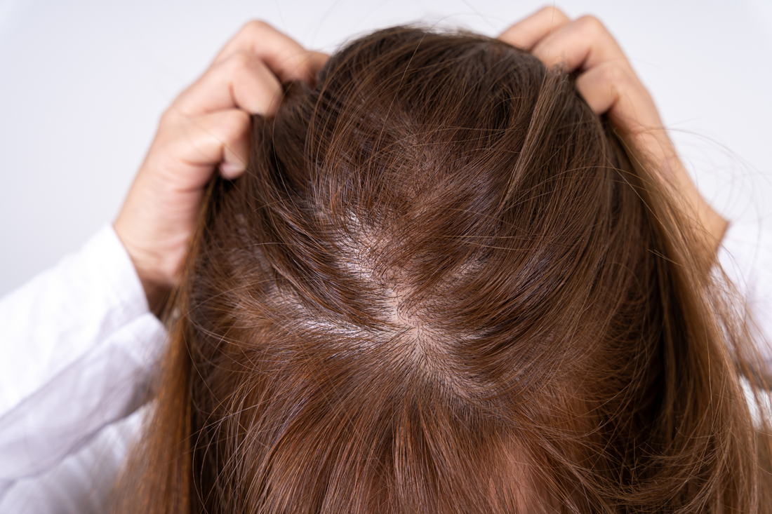First Signs of Hair Thinning