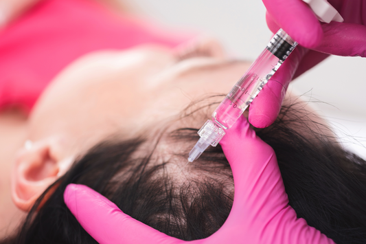 What are PRF Injections for Hair Loss?