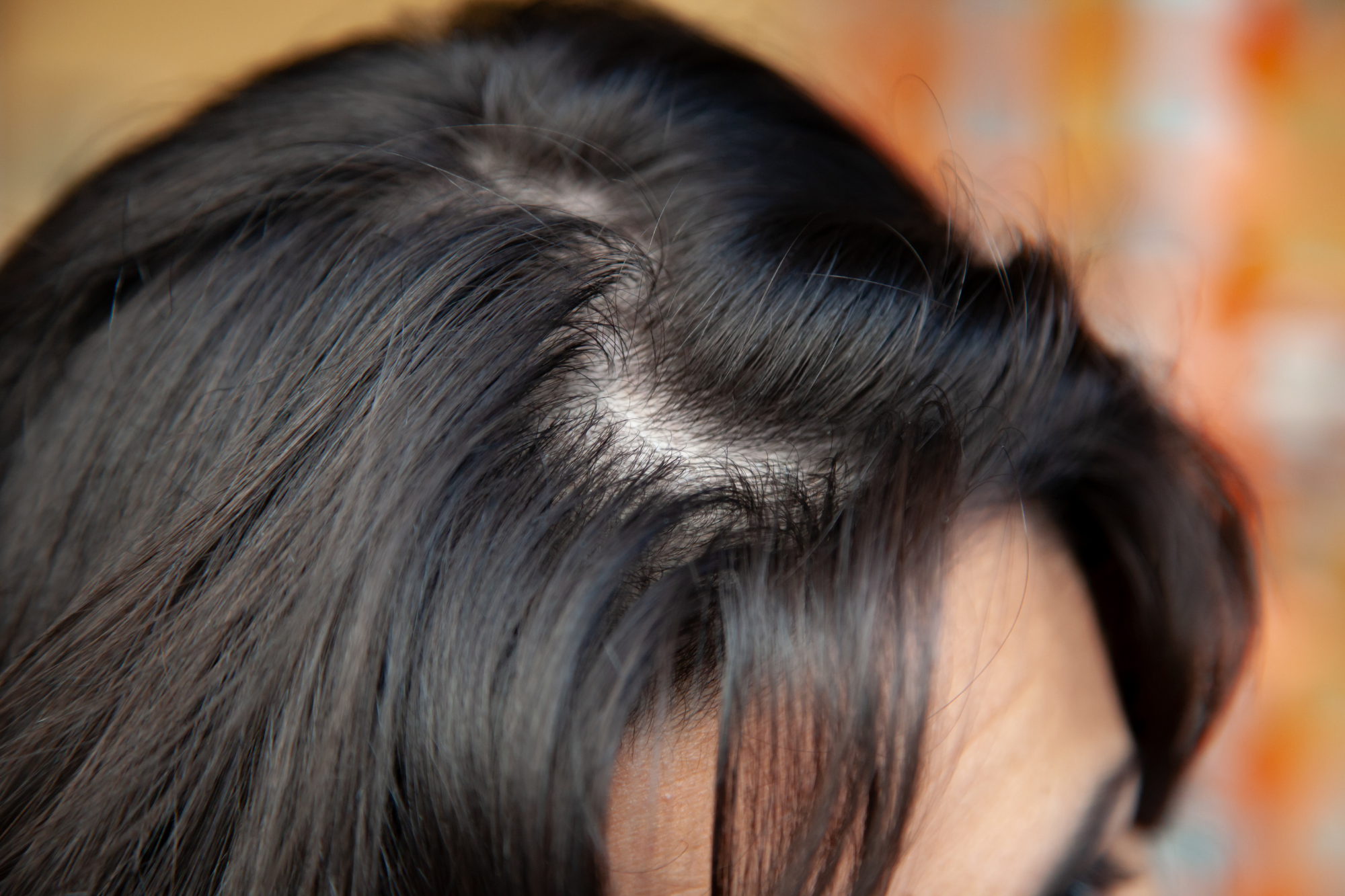 Experts Say These Are The Worst Hairstyles For Thin, Fine And Aging Hair -  SHEfinds