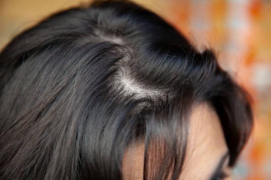 woman with thinning hair